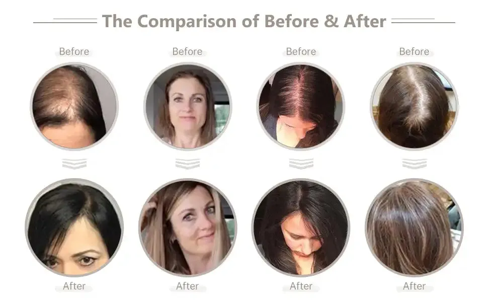 Silk Base Top Real Human Hair Extension With Thin Breathable Blonde Hair Toppers